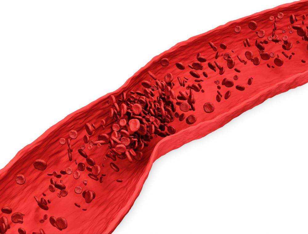 What are high blood platelets a sign of?