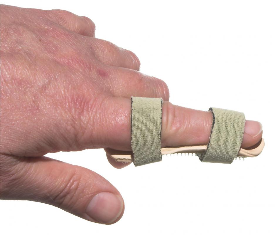 Thumb Immobilization Splint