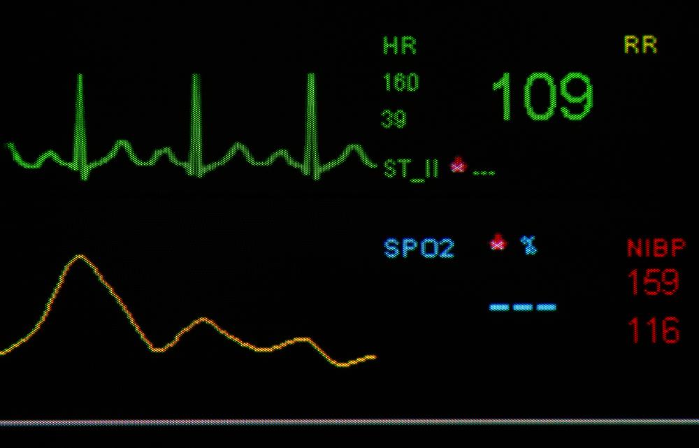 Resting Heart Range Chart