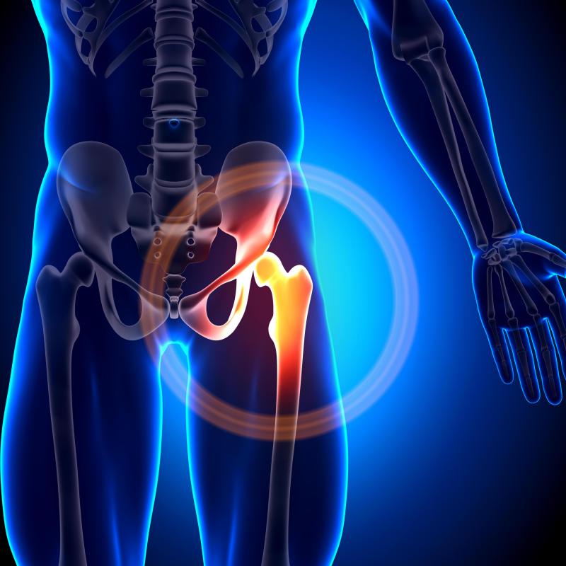 What are possible causes of right side groin pain in women?