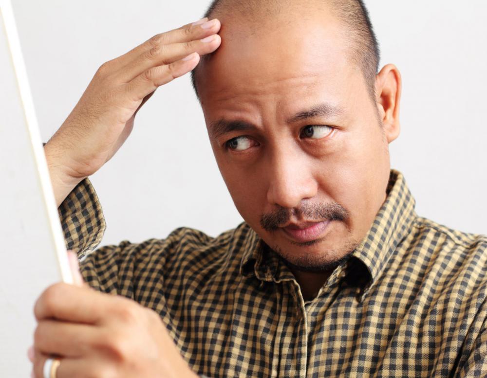 Nettle root is found in topical hair loss treatments.