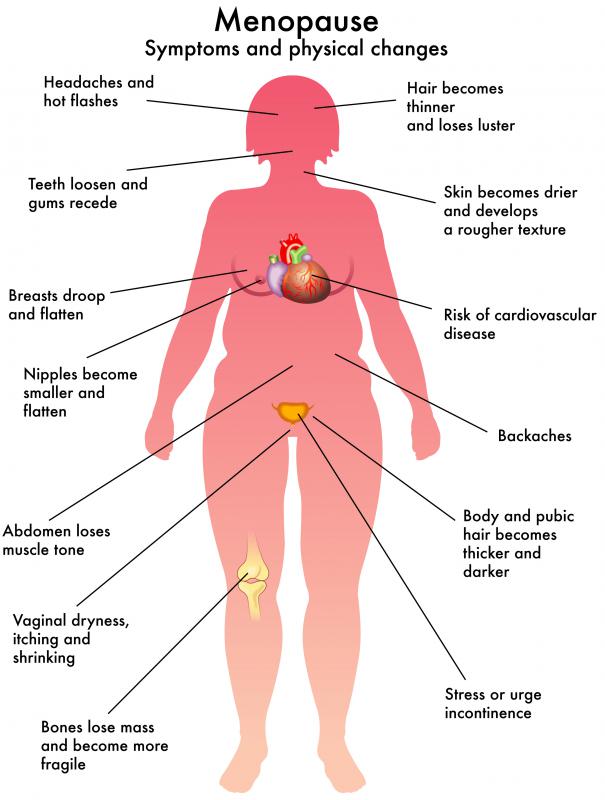 What are the side effects of high estrogen levels?