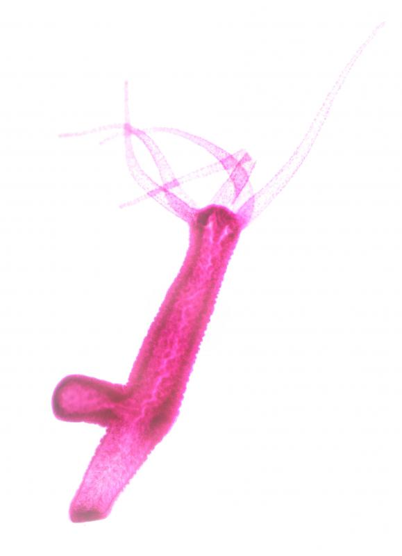 Hydras do not have body cavities.