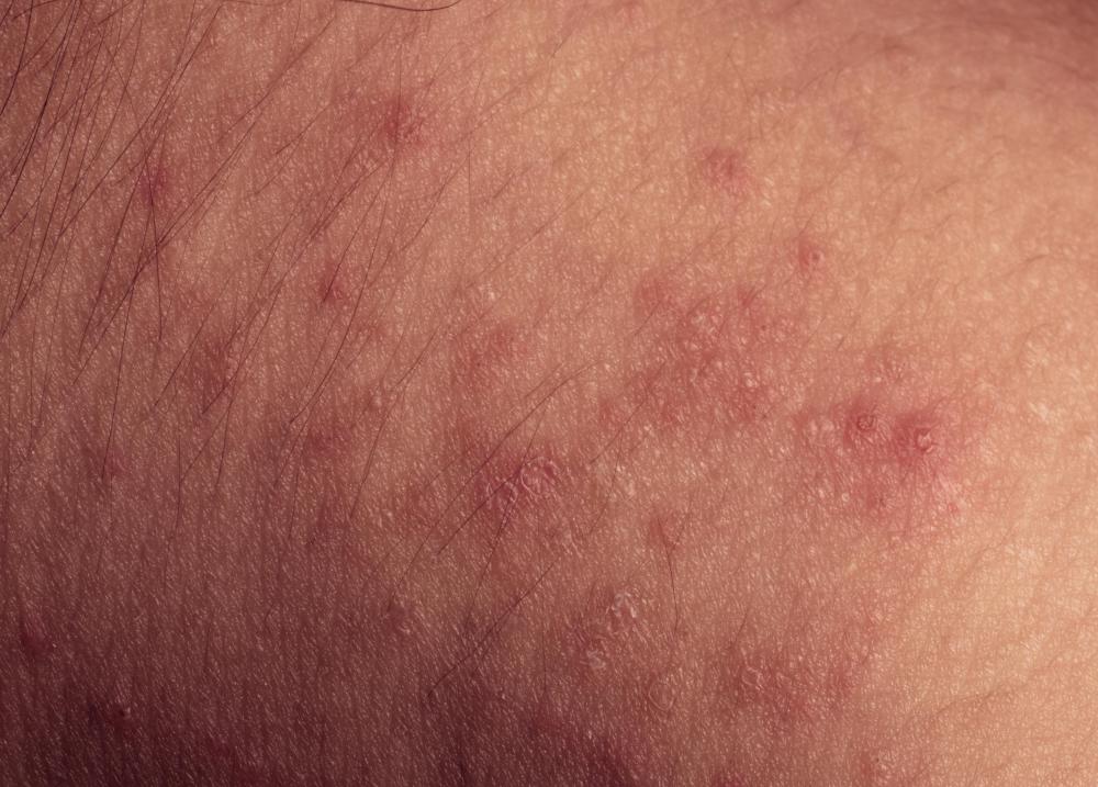 Red spots and Skin rash: Common Related Medical Conditions