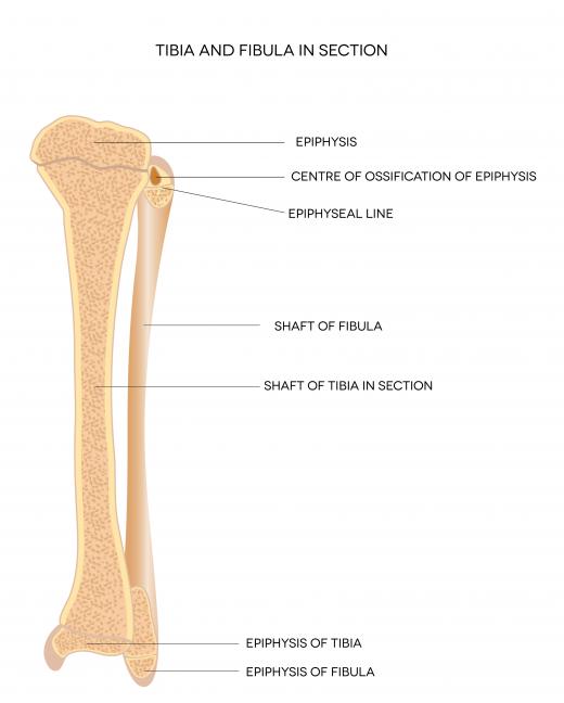 The tibial tuberosity is located near the top of the tibia, which is the larger of the lower leg bones (left), just below the kneecap.