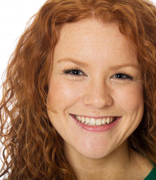 Freckles are common among redheads.