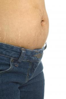 Organic cocoa butter may help with stretch marks