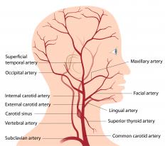 A diagram of the human head and neck, including the arteries in red.