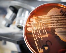 A dish of klebsiella oxytoca bacteria.