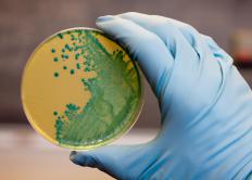 Bacteria in a petri dish.