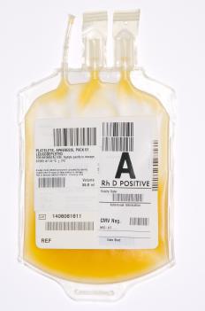 A bag of blood plasma.