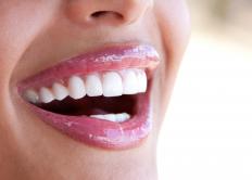 A woman with healthy gums.