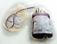 People with bone marrow failure may require blood transfusions.