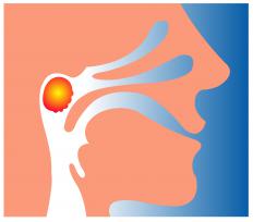 A human head with the adenoids in red and yellow.