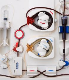 A hemodialysis machine cleans a person's blood when his or her kidneys can't function properly.