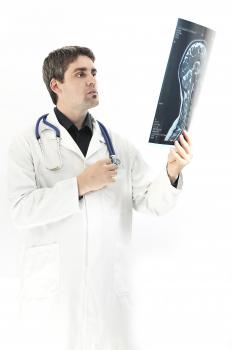 A doctor reviewing an imaging study of a head injury.
