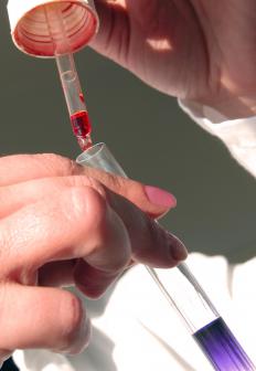 Epoxy is much better at resisting the effects of acids and bases than urethane.