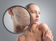 Dry skin can be a symptom of low progesterone.