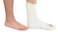 A person with a plaster of Paris cast.
