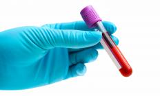 A blood sample for a test.