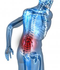 A person with low back pain.