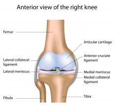 A diagram of the knee, showing the lateral and medial menisci.