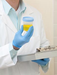 A urinalysis is often used to help diagnose Barth syndrome.