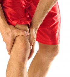 A man with leg pain caused by connective tissue disease.