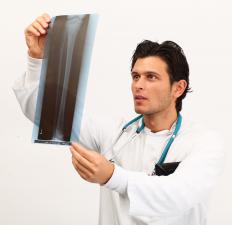 An orthopedic surgeon looking at the X-ray of a patient with joint problems.