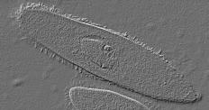 Paramecium with cilia