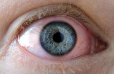 Toxins that enter the body as vapors can damage the eyes and cause painful irritation.