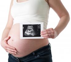 Sonograms can offer views of an unborn child. 