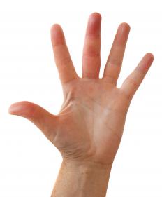 A person with swollen hands.