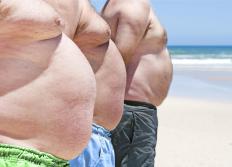 Three men with fat around the greater omentum.