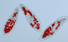 Three paramecia photographed with a digital microscope camera.