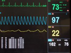 A vital signs monitor, which is used in caring for those on life support.