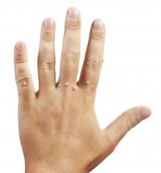 Warts on a hand