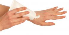 A woman applying an anti-itch cream to a mosquito bite.