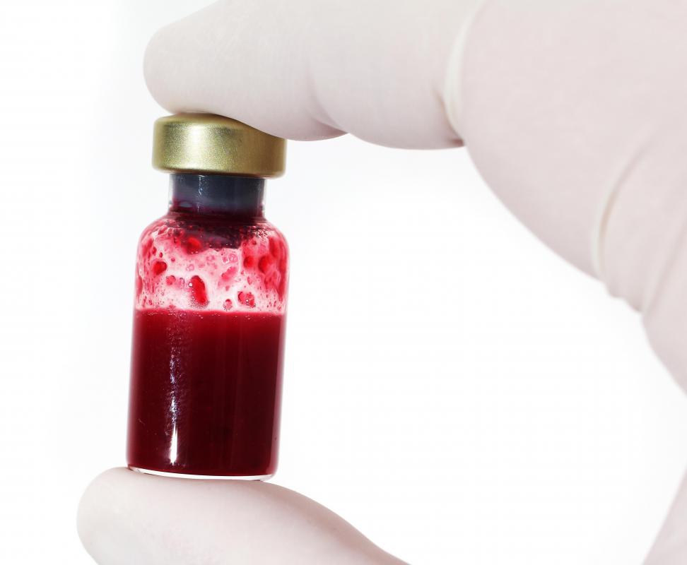 A blood test may be performed to diagnose Mediterranean anemia.