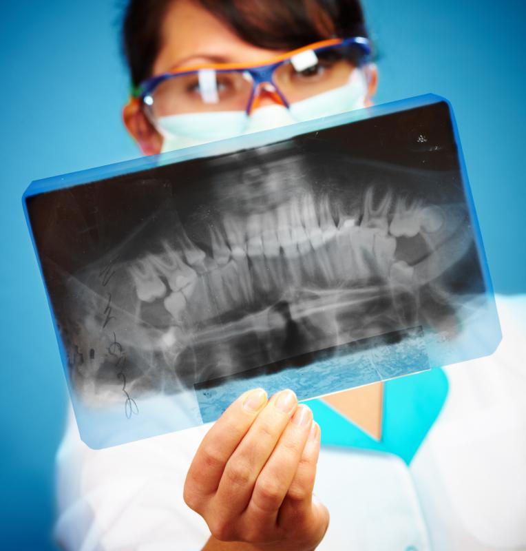 Sometimes, dentists will order a complete set of X-rays to gain images of the entire mouth.