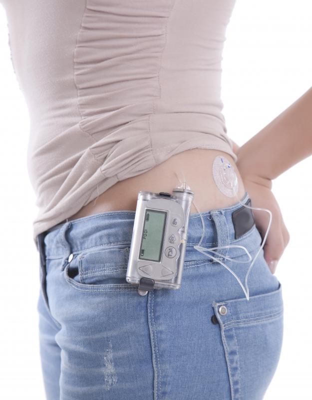 Diabetics may benefit from infrared light therapy.