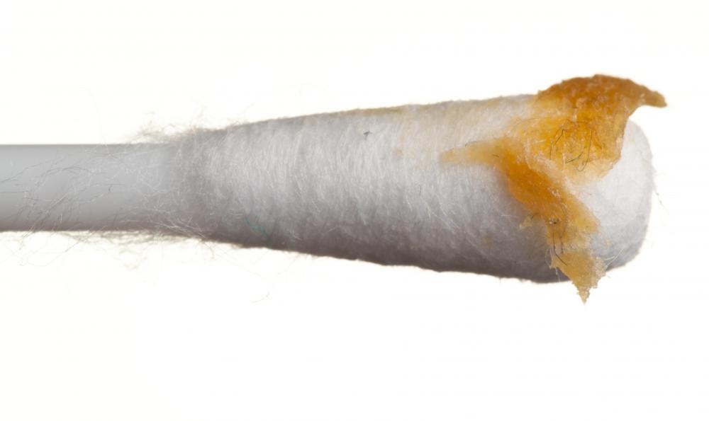 What are the best methods of home earwax removal?