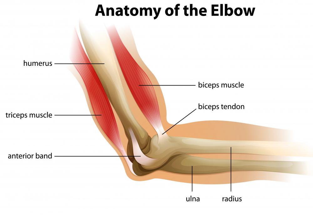 What is the Distal Biceps Tendon? (with pictures)