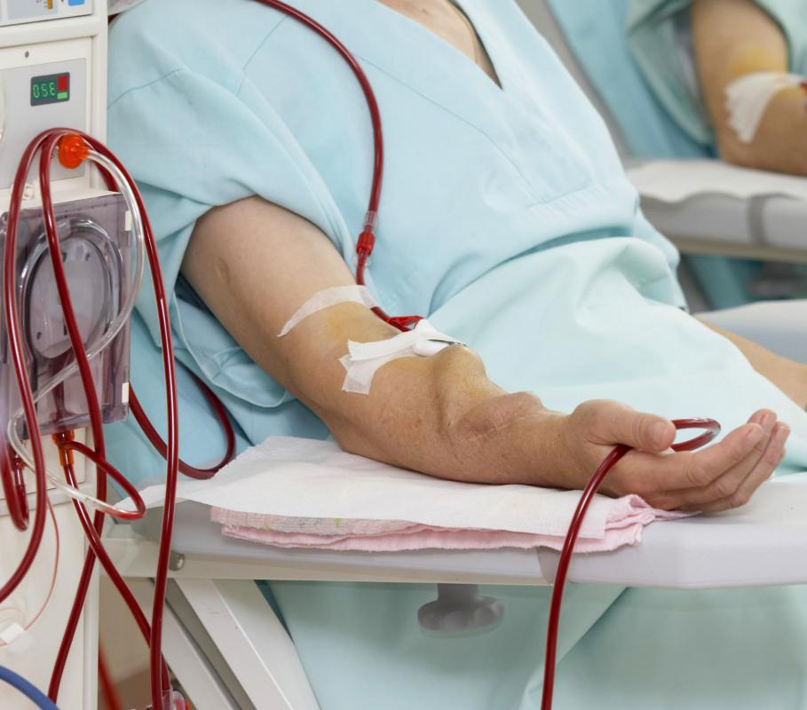 Can You Do Dialysis Every Day