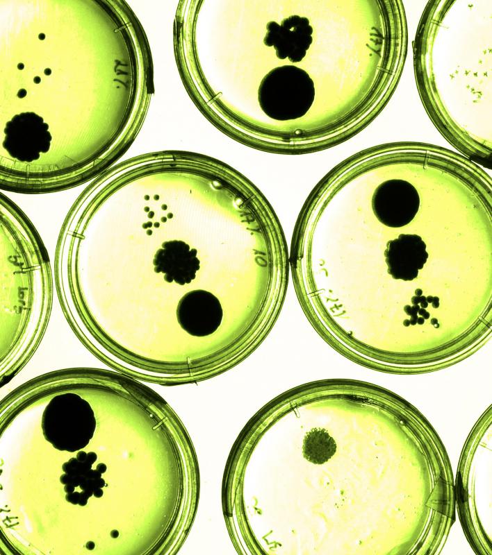 What is a Petri Dish? (with pictures)