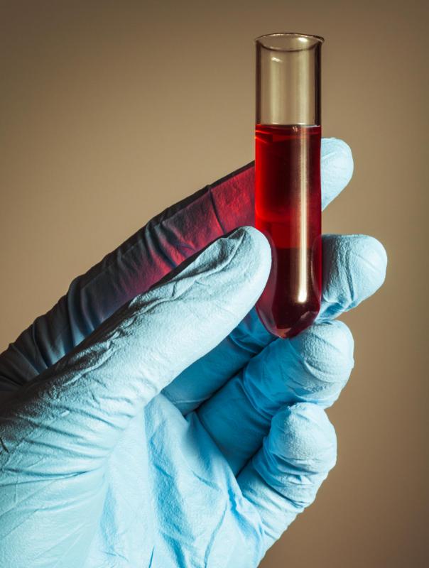 hepatitis a transmission blood