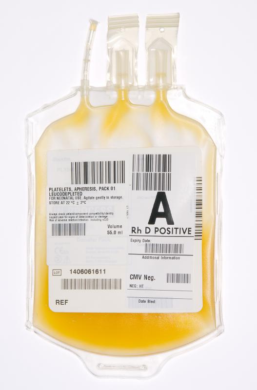 What is Apheresis? (with pictures)