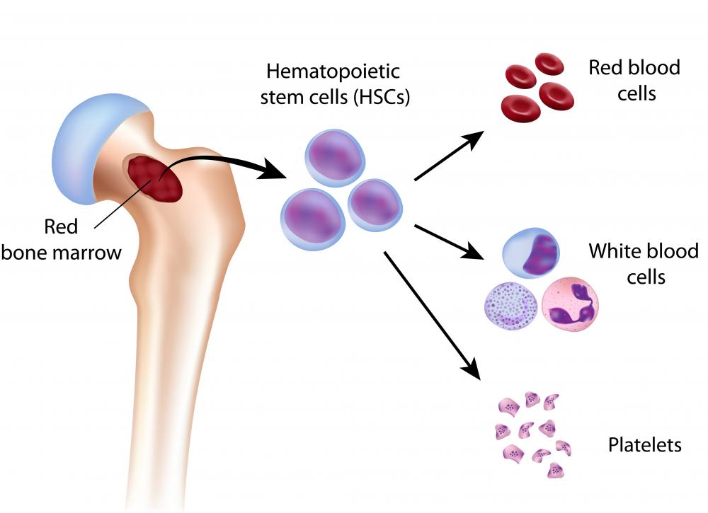 What are the Different Types of Bone Marrow? (with pictures)