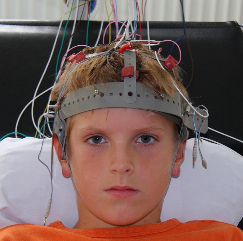 what is a eeg test