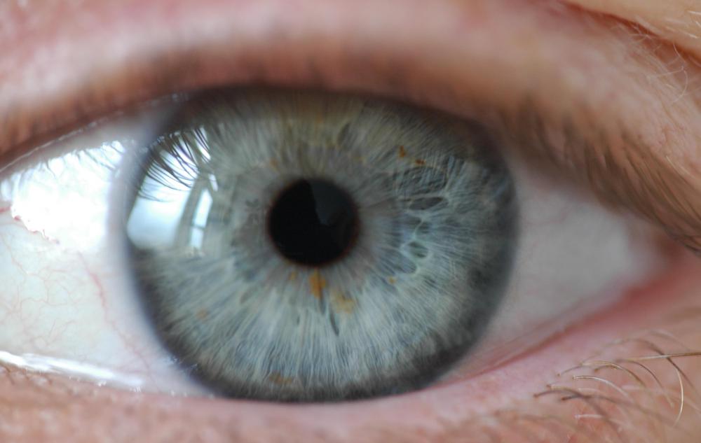 large pupils